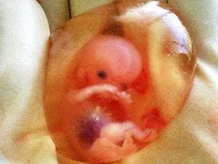 10 week old human fetus with