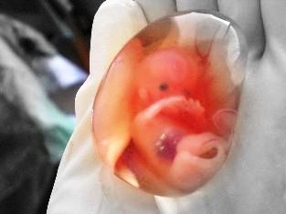10 week old human fetus