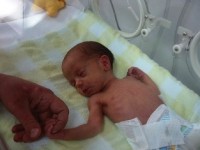 File photo of premature baby (Credit: César Rincón)